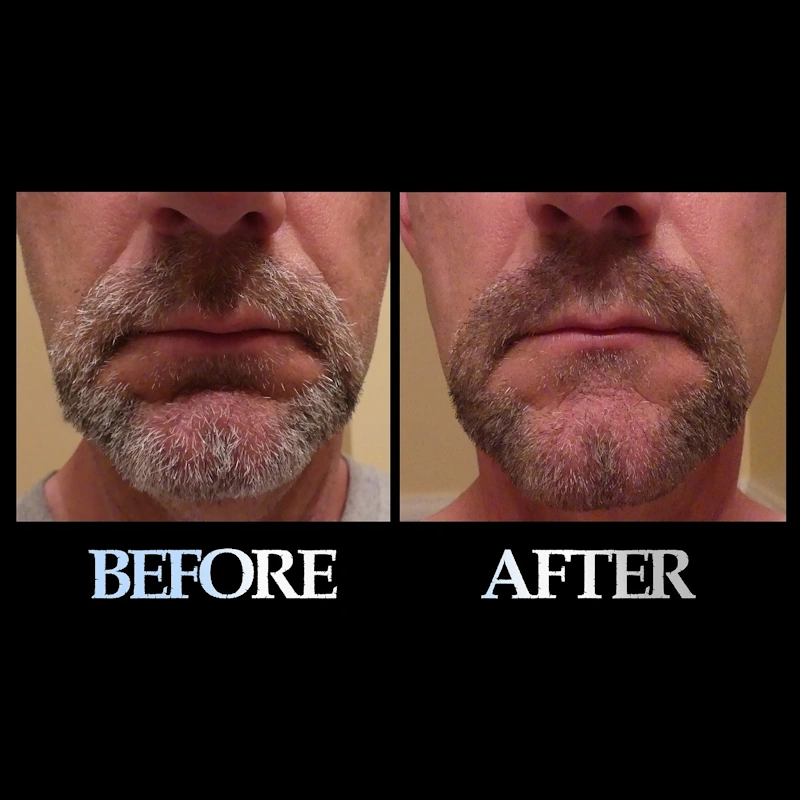 Blackbeard for men light medium brown before and after